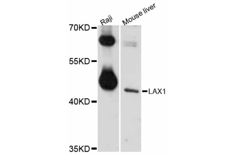 Western Blot - Anti-LAX1 Antibody (A12218) - Antibodies.com