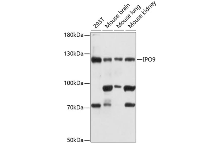 Western Blot - Anti-Importin 9/RANBP9 Antibody (A81140) - Antibodies.com