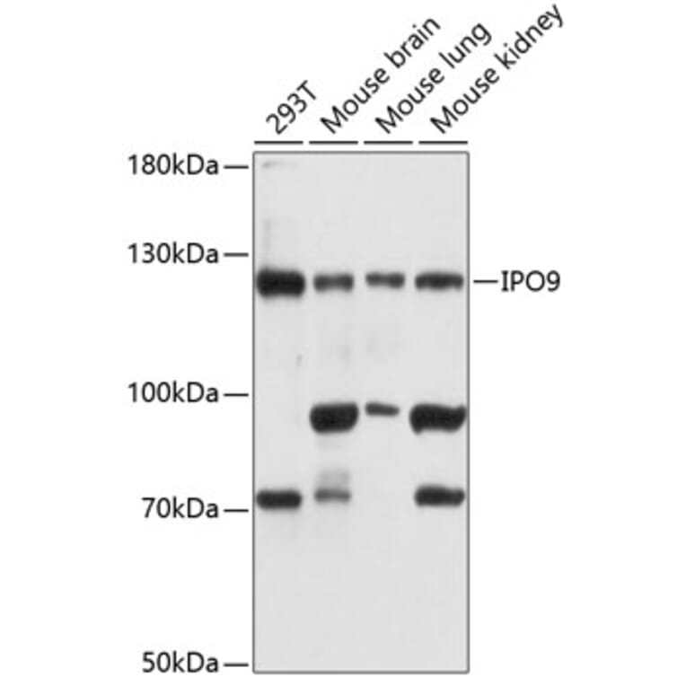 Western Blot - Anti-Importin 9/RANBP9 Antibody (A81140) - Antibodies.com