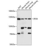 Western Blot - Anti-Importin 9/RANBP9 Antibody (A81140) - Antibodies.com