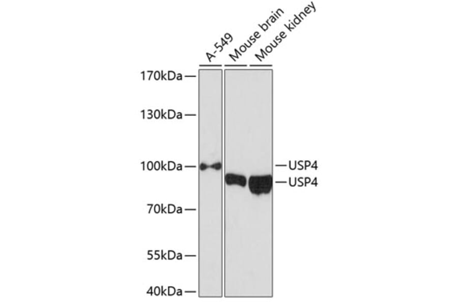 Western Blot - Anti-USP4 Antibody (A12242) - Antibodies.com