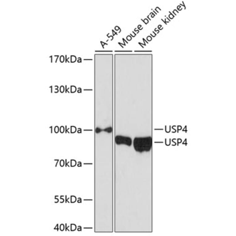 Western Blot - Anti-USP4 Antibody (A12242) - Antibodies.com