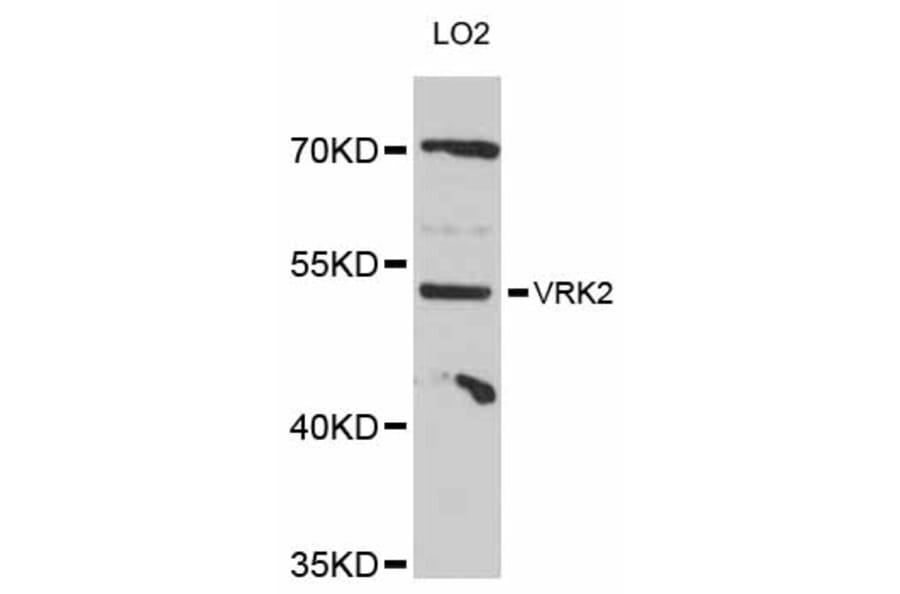 Western Blot - Anti-VRK2 Antibody (A12243) - Antibodies.com