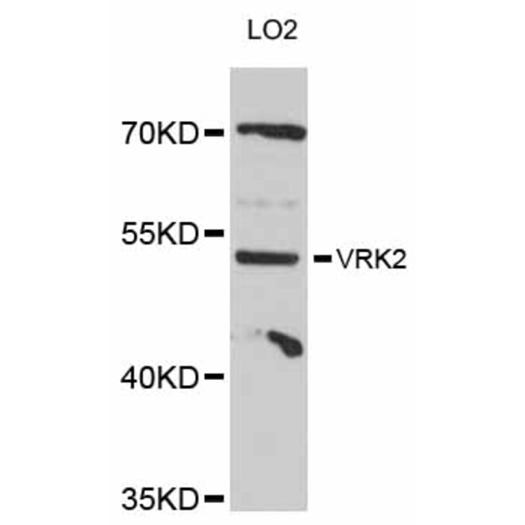 Western Blot - Anti-VRK2 Antibody (A12243) - Antibodies.com