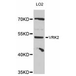 Western Blot - Anti-VRK2 Antibody (A12243) - Antibodies.com