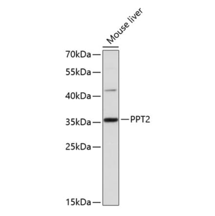 Western Blot - Anti-PPT2 Antibody (A81143) - Antibodies.com