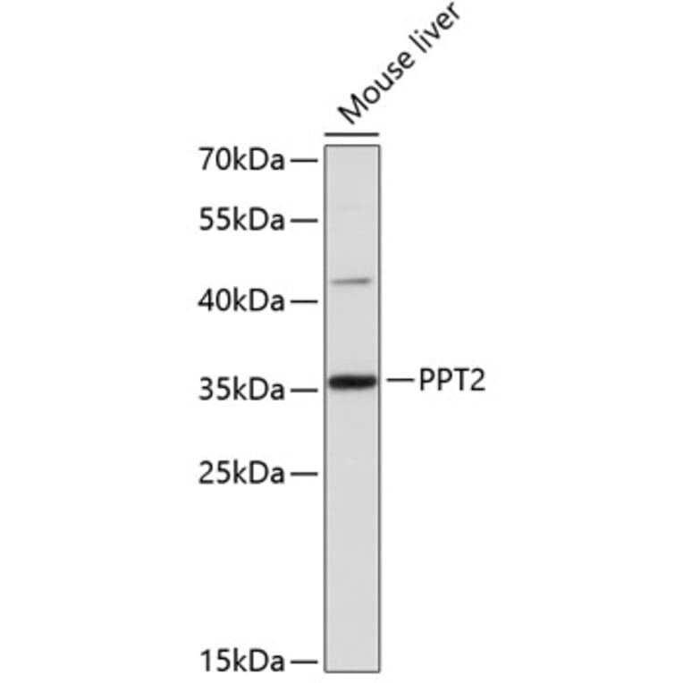 Western Blot - Anti-PPT2 Antibody (A81143) - Antibodies.com