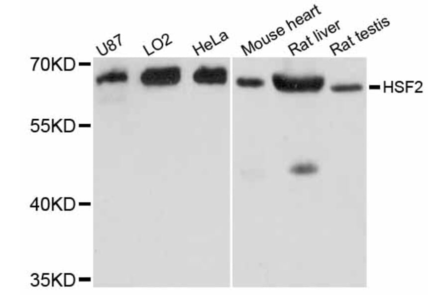 Western Blot - Anti-HSF2 Antibody (A12264) - Antibodies.com