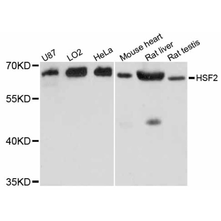 Western Blot - Anti-HSF2 Antibody (A12264) - Antibodies.com