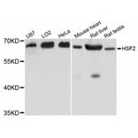 Western Blot - Anti-HSF2 Antibody (A12264) - Antibodies.com