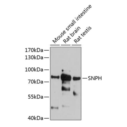 Western Blot - Anti-SNPH Antibody (A81146) - Antibodies.com