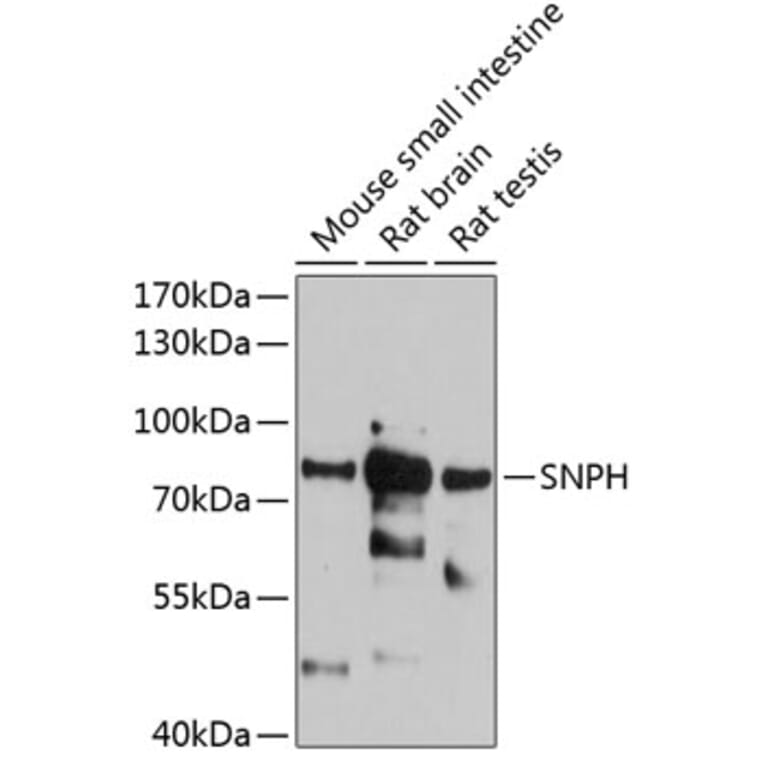 Western Blot - Anti-SNPH Antibody (A81146) - Antibodies.com