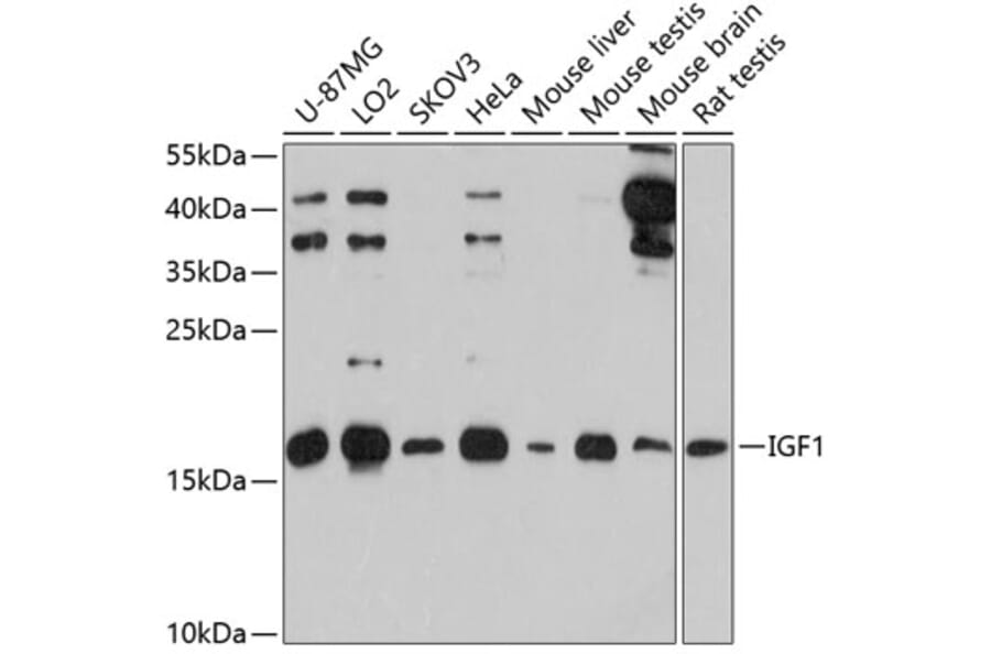 Western Blot - Anti-IGF1 Antibody (A12305) - Antibodies.com