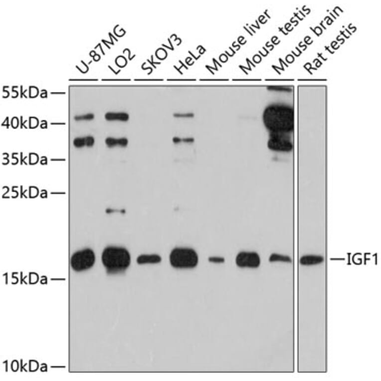 Western Blot - Anti-IGF1 Antibody (A12305) - Antibodies.com