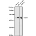 Western Blot - Anti-NSE/ENO2 Antibody (A81148) - Antibodies.com
