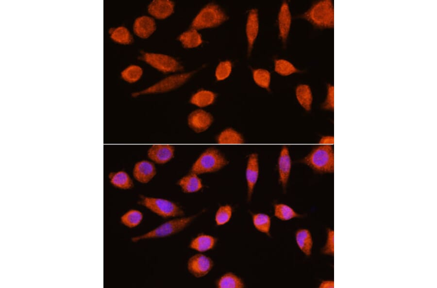 Immunofluorescence - Anti-NSE/ENO2 Antibody (A81148) - Antibodies.com