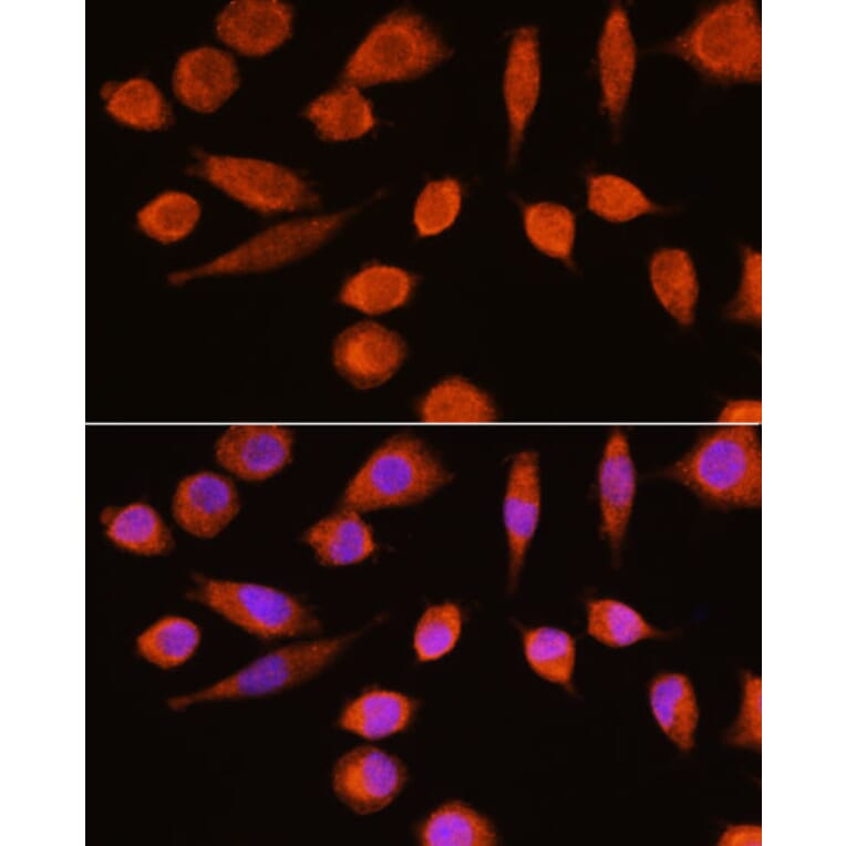 Immunofluorescence - Anti-NSE/ENO2 Antibody (A81148) - Antibodies.com
