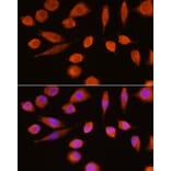 Immunofluorescence - Anti-NSE/ENO2 Antibody (A81148) - Antibodies.com