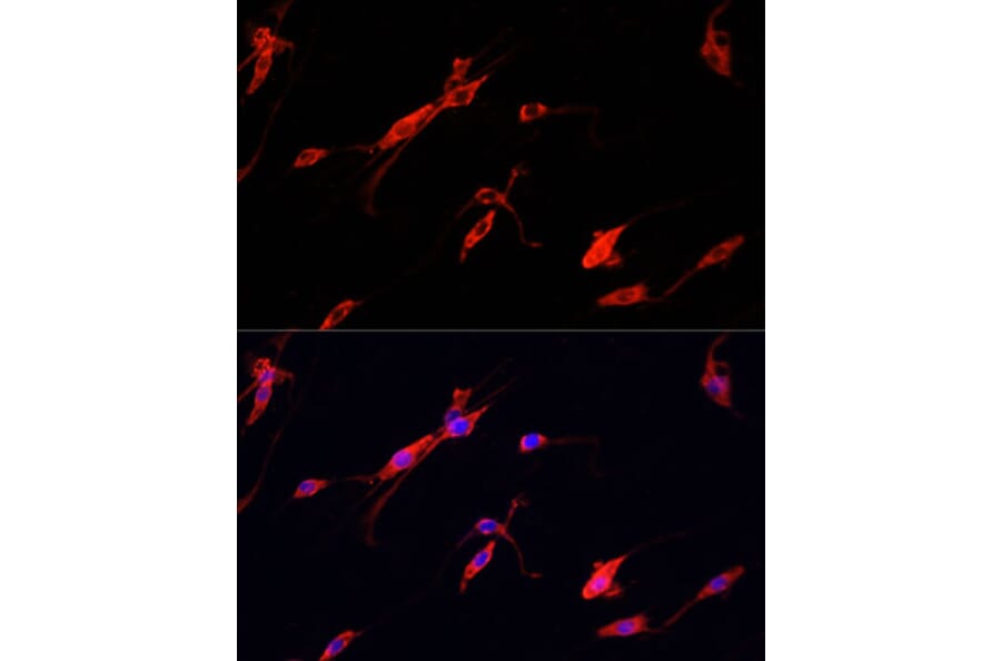 Immunofluorescence - Anti-NSE/ENO2 Antibody (A81148) - Antibodies.com