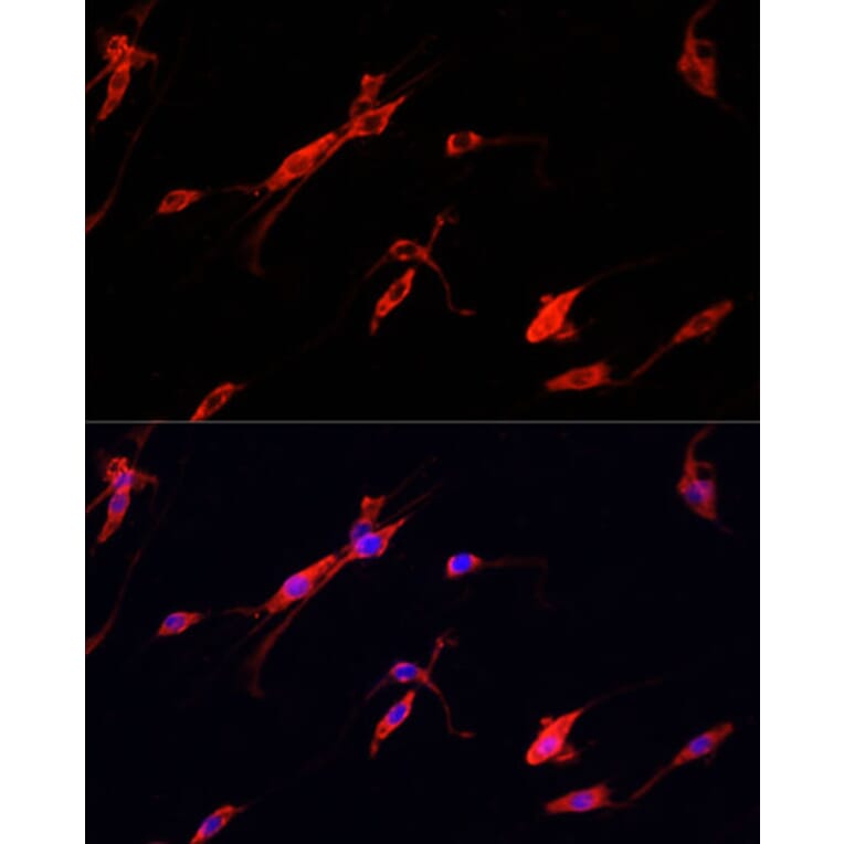 Immunofluorescence - Anti-NSE/ENO2 Antibody (A81148) - Antibodies.com