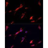 Immunofluorescence - Anti-NSE/ENO2 Antibody (A81148) - Antibodies.com