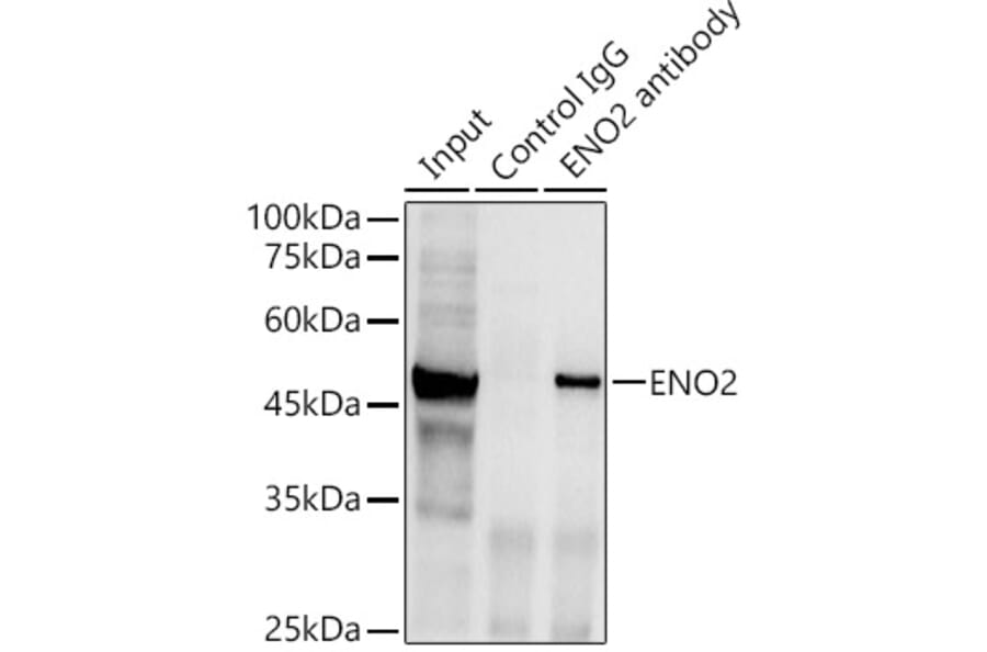 Western Blot - Anti-NSE/ENO2 Antibody (A81148) - Antibodies.com