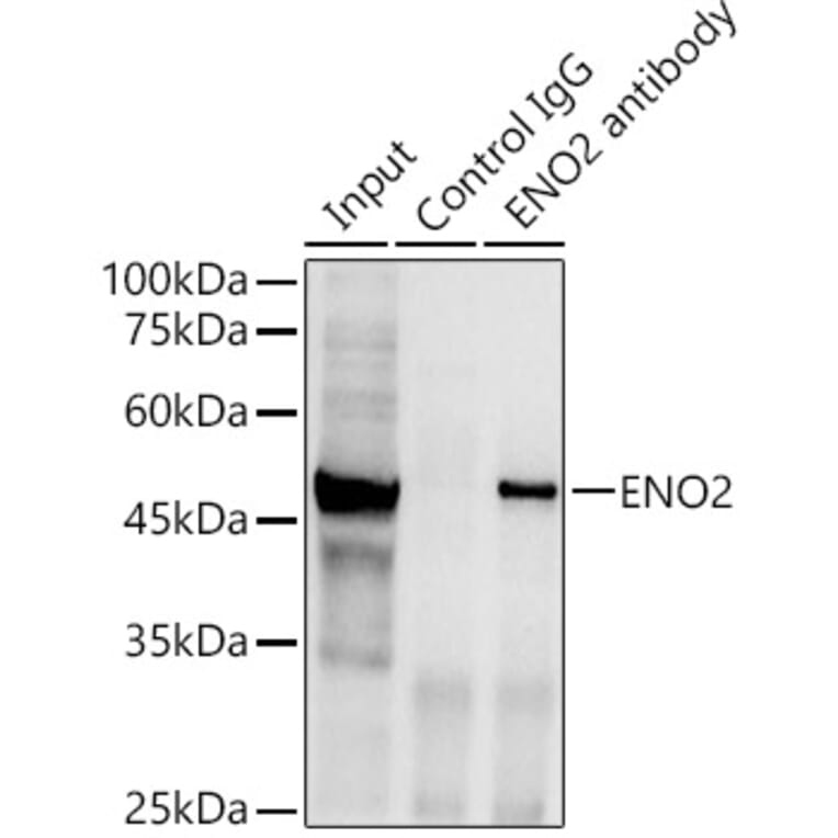 Western Blot - Anti-NSE/ENO2 Antibody (A81148) - Antibodies.com
