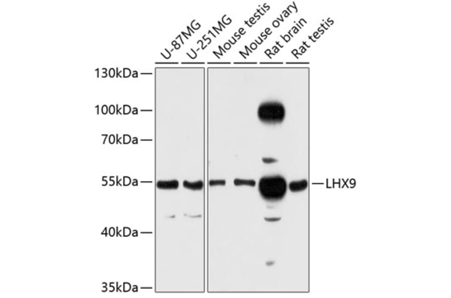 Western Blot - Anti-LHX9 Antibody (A81149) - Antibodies.com