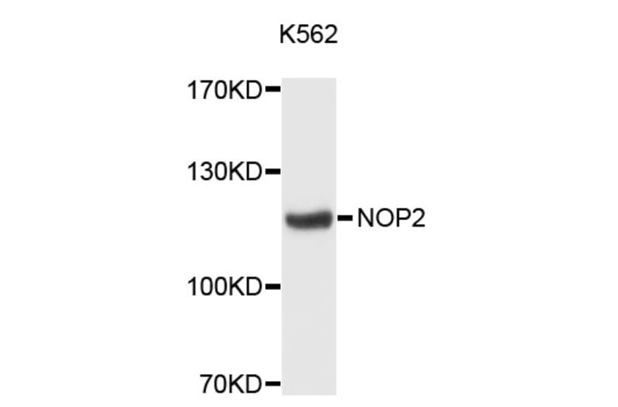 Western Blot - Anti-NOP2 Antibody (A12719) - Antibodies.com