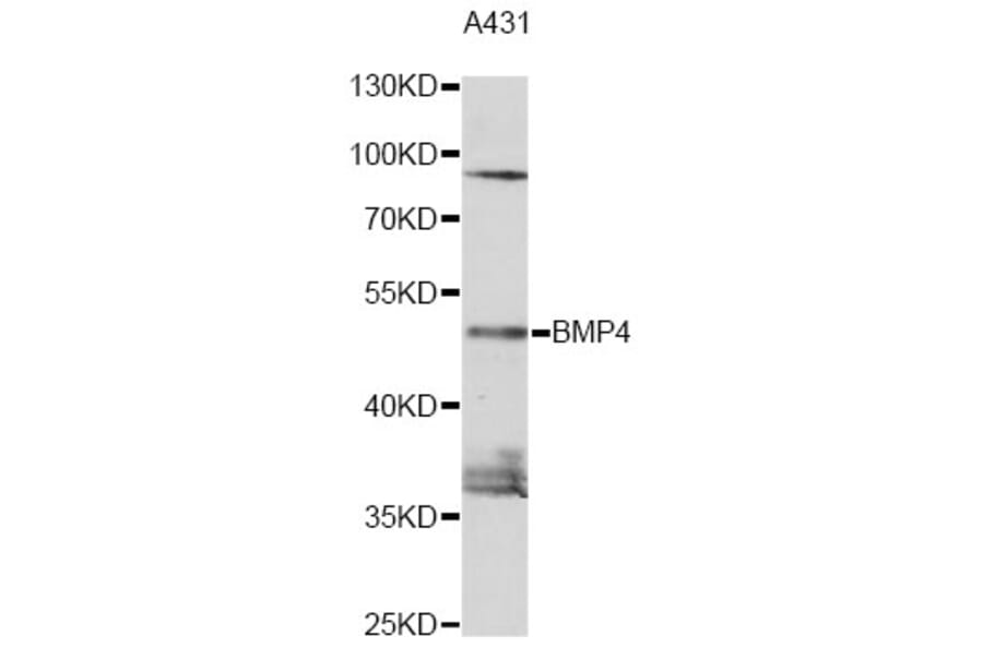 Western Blot - Anti-BMP4 Antibody (A0425) - Antibodies.com