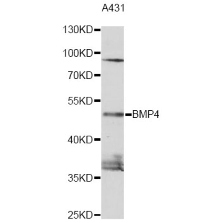 Western Blot - Anti-BMP4 Antibody (A0425) - Antibodies.com