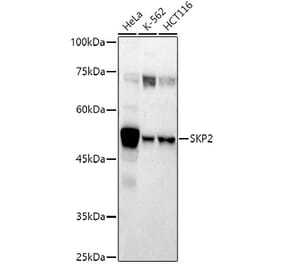 Western Blot - Anti-SKP2 Antibody (A81152) - Antibodies.com