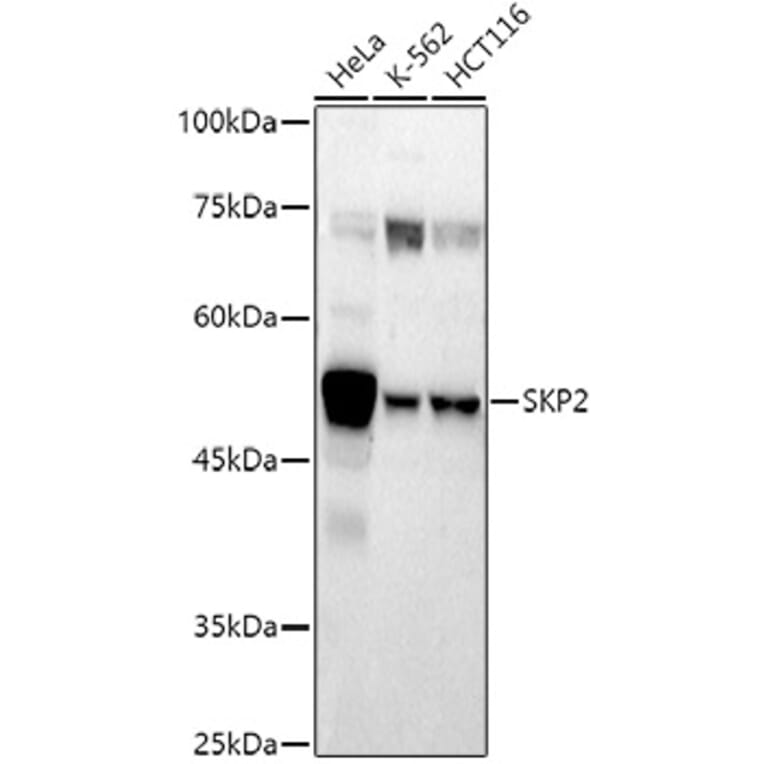 Western Blot - Anti-SKP2 Antibody (A81152) - Antibodies.com