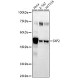 Western Blot - Anti-SKP2 Antibody (A81152) - Antibodies.com