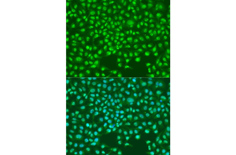 Immunofluorescence - Anti-SKP2 Antibody (A81152) - Antibodies.com