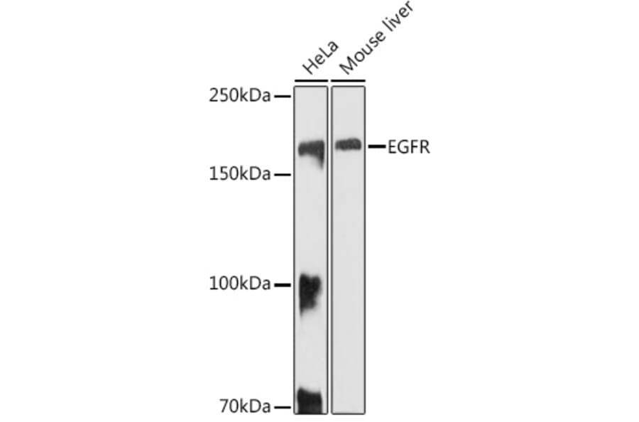 Western Blot - Anti-EGFR Antibody (A81153) - Antibodies.com