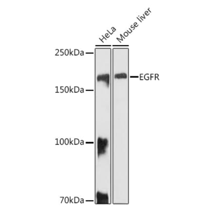 Western Blot - Anti-EGFR Antibody (A81153) - Antibodies.com