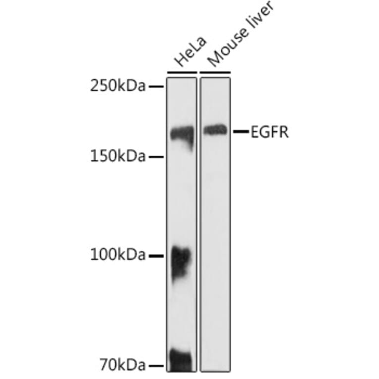 Western Blot - Anti-EGFR Antibody (A81153) - Antibodies.com