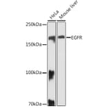 Western Blot - Anti-EGFR Antibody (A81153) - Antibodies.com