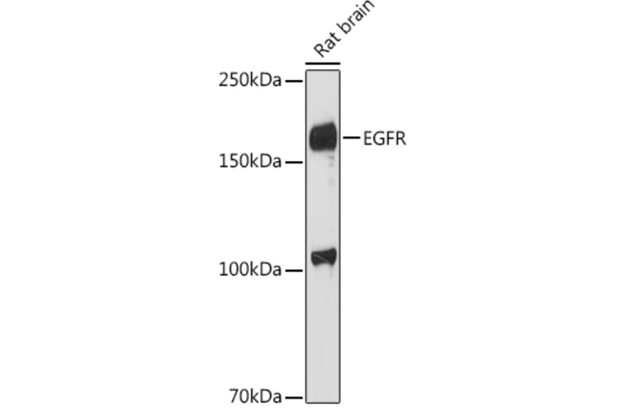 Western Blot - Anti-EGFR Antibody (A81153) - Antibodies.com