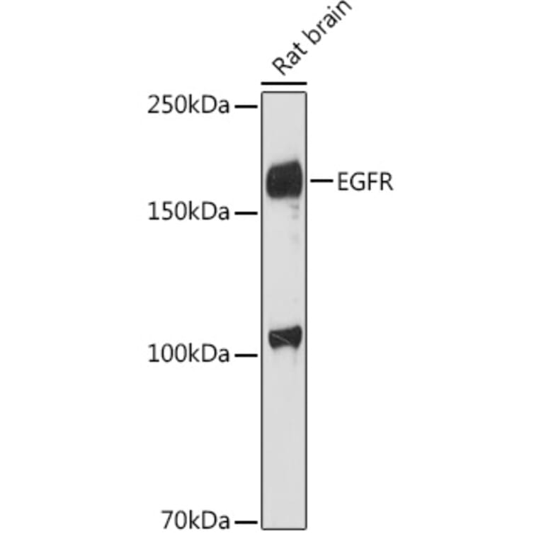 Western Blot - Anti-EGFR Antibody (A81153) - Antibodies.com