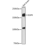 Western Blot - Anti-EGFR Antibody (A81153) - Antibodies.com