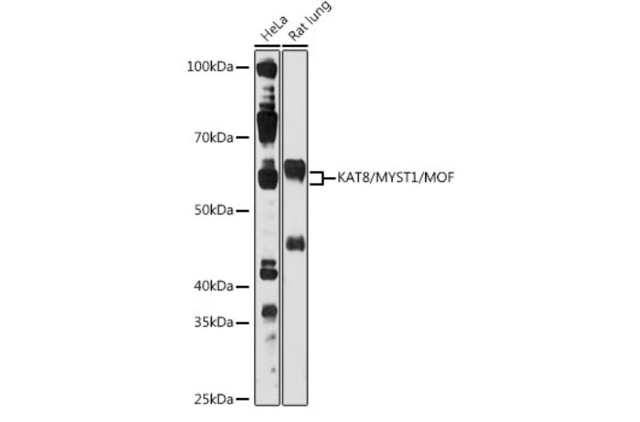 Western Blot - Anti-KAT8/MYST1/MOF Antibody (A81154) - Antibodies.com