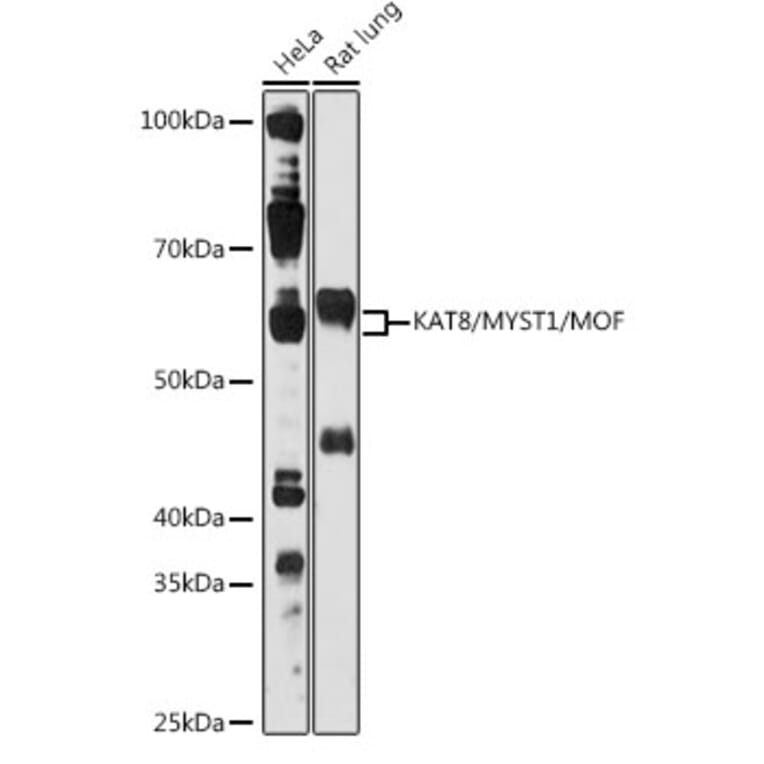 Western Blot - Anti-KAT8/MYST1/MOF Antibody (A81154) - Antibodies.com