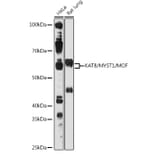 Western Blot - Anti-KAT8/MYST1/MOF Antibody (A81154) - Antibodies.com