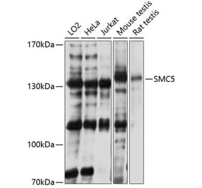 Western Blot - Anti-SMC5 Antibody (A81155) - Antibodies.com