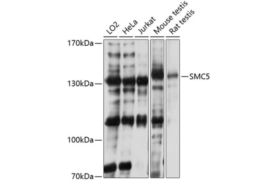 Western Blot - Anti-SMC5 Antibody (A81155) - Antibodies.com