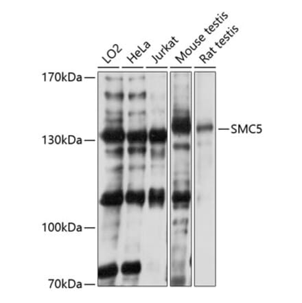 Western Blot - Anti-SMC5 Antibody (A81155) - Antibodies.com