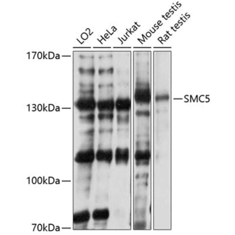 Western Blot - Anti-SMC5 Antibody (A81155) - Antibodies.com