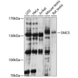 Western Blot - Anti-SMC5 Antibody (A81155) - Antibodies.com